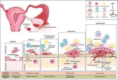 Aged garlic extract as a potential prophylactic to reduce the progression of endometriosis and associated pain burden